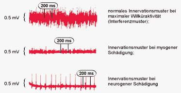 Elektromyografie