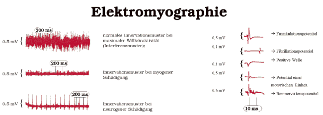 Elektromyographie